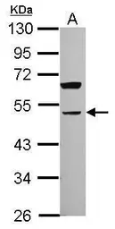 Anti-Parvin alpha antibody used in Western Blot (WB). GTX118414