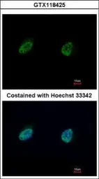 Anti-NUFIP1 antibody used in Immunocytochemistry/ Immunofluorescence (ICC/IF). GTX118425