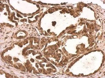 Anti-NUFIP1 antibody used in IHC (Paraffin sections) (IHC-P). GTX118425