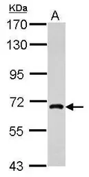 Anti-NUFIP1 antibody used in Western Blot (WB). GTX118425