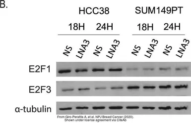 Anti-E2F3 antibody [PG30] used in Western Blot (WB). GTX11843