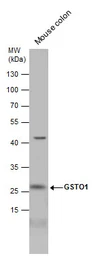 Anti-GSTO1 antibody used in Western Blot (WB). GTX118439