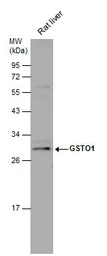 Anti-GSTO1 antibody used in Western Blot (WB). GTX118439