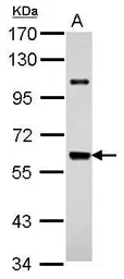 Anti-UAP1 antibody used in Western Blot (WB). GTX118446