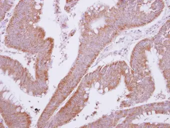 Anti-MTMR9 antibody used in IHC (Paraffin sections) (IHC-P). GTX118447