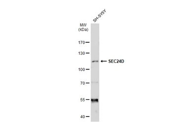 Anti-SEC24D antibody [C2C3], C-term used in Western Blot (WB). GTX118462