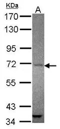 Anti-AMOT antibody [N3C1], Internal used in Western Blot (WB). GTX118474