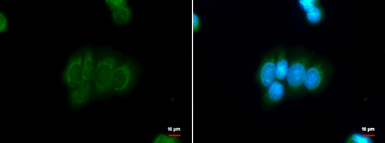 Anti-DBC1 antibody [N1N2], N-term used in Immunocytochemistry/ Immunofluorescence (ICC/IF). GTX118477