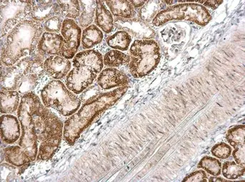 Anti-DBC1 antibody [N1N2], N-term used in IHC (Paraffin sections) (IHC-P). GTX118477