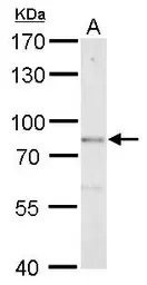 Anti-DBC1 antibody [N1N2], N-term used in Western Blot (WB). GTX118477