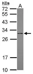 Anti-DCI antibody [N1C2] used in Western Blot (WB). GTX118478