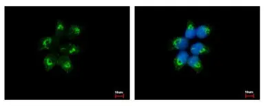Anti-EIF1A antibody used in Immunocytochemistry/ Immunofluorescence (ICC/IF). GTX118482