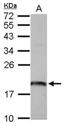 Anti-ARL1 antibody used in Western Blot (WB). GTX118495