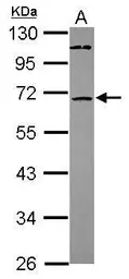 Anti-ST6GALNAC1 antibody [N2C2], Internal used in Western Blot (WB). GTX118505