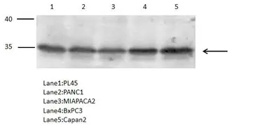 Anti-PTGR1 antibody [N1C2] used in Western Blot (WB). GTX118527