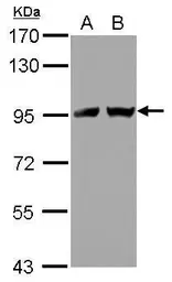 Anti-TNPO2 antibody used in Western Blot (WB). GTX118529