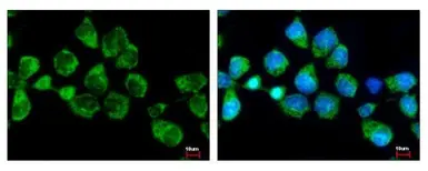 Anti-SNX5 antibody [N2C2], Internal used in Immunocytochemistry/ Immunofluorescence (ICC/IF). GTX118542
