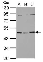 Anti-SNX5 antibody [N2C2], Internal used in Western Blot (WB). GTX118542