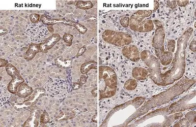 Anti-SNX5 antibody [N2C2], Internal used in IHC (Paraffin sections) (IHC-P). GTX118542