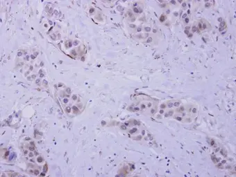 Anti-HIP55 antibody [N1N3] used in IHC (Paraffin sections) (IHC-P). GTX118543
