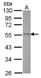 Anti-HIP55 antibody [N1N3] used in Western Blot (WB). GTX118543