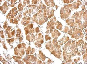 Anti-EFHA1 antibody used in IHC (Paraffin sections) (IHC-P). GTX118555