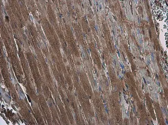 Anti-EFHA1 antibody used in IHC (Paraffin sections) (IHC-P). GTX118555