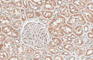 Anti-EFHA1 antibody used in IHC (Paraffin sections) (IHC-P). GTX118555