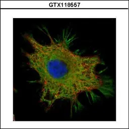 Anti-Ymer antibody used in Immunocytochemistry/ Immunofluorescence (ICC/IF). GTX118557