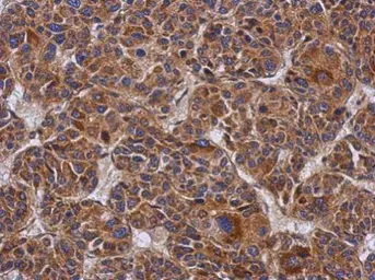 Anti-Ymer antibody used in IHC (Paraffin sections) (IHC-P). GTX118557