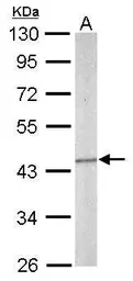 Anti-SEPT5 antibody [N3C3] used in Western Blot (WB). GTX118561