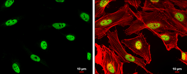 Anti-DPPA4 antibody [N1C3] used in Immunocytochemistry/ Immunofluorescence (ICC/IF). GTX118569