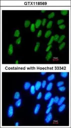 Anti-DPPA4 antibody [N1C3] used in Immunocytochemistry/ Immunofluorescence (ICC/IF). GTX118569