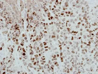 Anti-DPPA4 antibody [N1C3] used in IHC (Paraffin sections) (IHC-P). GTX118569