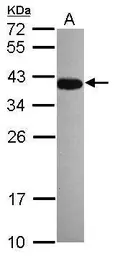 Anti-DPPA4 antibody [N1C3] used in Western Blot (WB). GTX118569