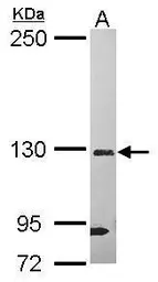 Anti-DHX37 antibody [C2C3], C-term used in Western Blot (WB). GTX118579