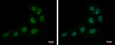 Anti-ZNF326 antibody [N1C1] used in Immunocytochemistry/ Immunofluorescence (ICC/IF). GTX118581