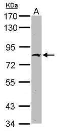 Anti-ZNF326 antibody [N1C1] used in Western Blot (WB). GTX118581
