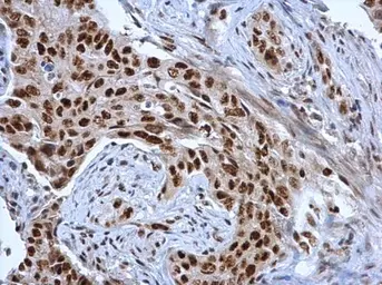 Anti-BAT1 antibody [C1C3] used in IHC (Paraffin sections) (IHC-P). GTX118582