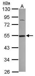 Anti-BAT1 antibody [C1C3] used in Western Blot (WB). GTX118582