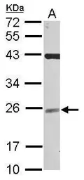 Anti-NCE2 antibody [N1C3] used in Western Blot (WB). GTX118584