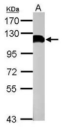 Anti-USP13 antibody [C2C3], C-term used in Western Blot (WB). GTX118595
