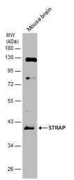 Anti-STRAP antibody [N1C3] used in Western Blot (WB). GTX118603