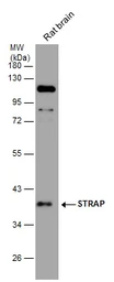 Anti-STRAP antibody [N1C3] used in Western Blot (WB). GTX118603