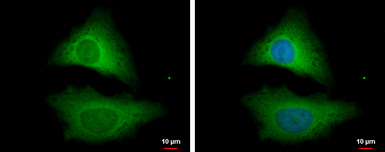 Anti-STRAP antibody [N1C3] used in Immunocytochemistry/ Immunofluorescence (ICC/IF). GTX118603