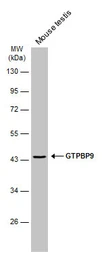 Anti-GTPBP9 antibody [N1C1] used in Western Blot (WB). GTX118604