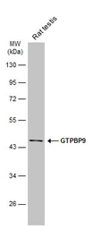 Anti-GTPBP9 antibody [N1C1] used in Western Blot (WB). GTX118604