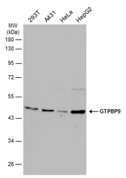 Anti-GTPBP9 antibody [N1C1] used in Western Blot (WB). GTX118604