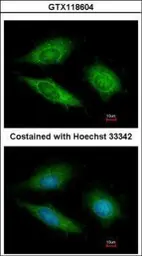 Anti-GTPBP9 antibody [N1C1] used in Immunocytochemistry/ Immunofluorescence (ICC/IF). GTX118604