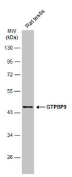 Anti-GTPBP9 antibody [C1C3] used in Western Blot (WB). GTX118605